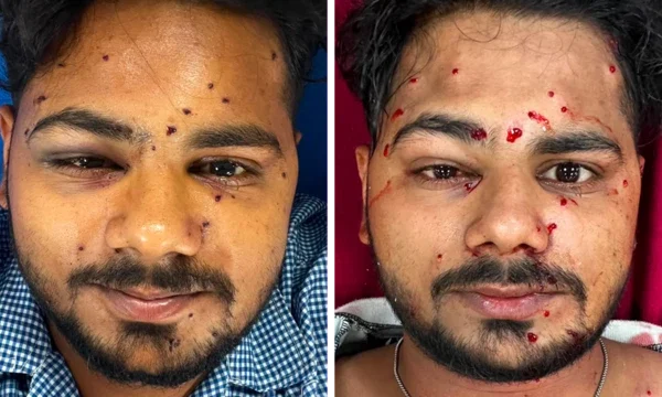 दिल्लीमा जेनजीलाई प्रतिबन्धित हतियारबाट दमन, विपक्षीले उठाइरहेछन् प्रश्न